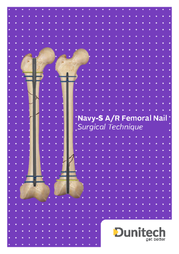 Navy-S Locking Femoral Nail Surgical Technique – Dunitech Nails