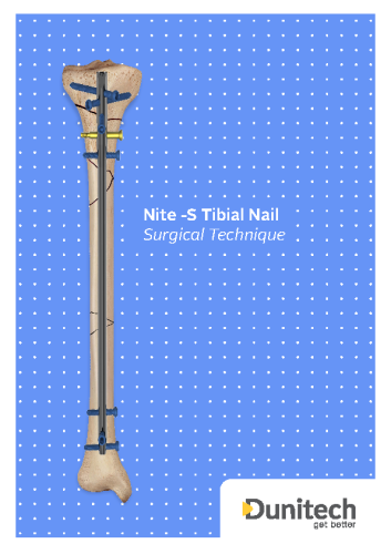 Nite-S Locking Tibial Nail Surgical Technique – Dunitech Nails