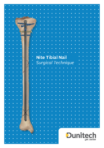 Nite-Tibial IM. Nail Surgical Technique